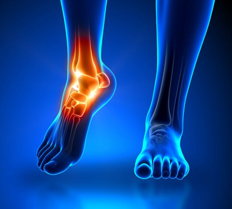 Ankle Instability and Sprains